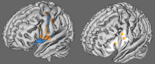 La neurociencia y el autismo